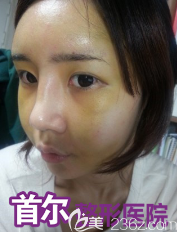 20190802_1564725365718618.png image.png