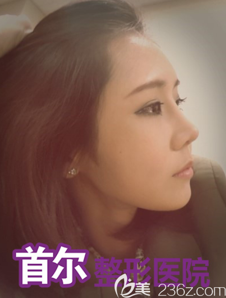 韩国首尔整形做鼻子怎么样 韩国首尔整形做鼻子怎么样