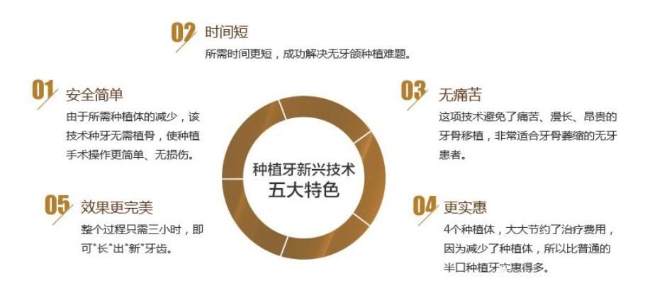 曙光口腔ALL-ON-4种植牙优势 曙光口腔ALL-ON-4种植牙优势