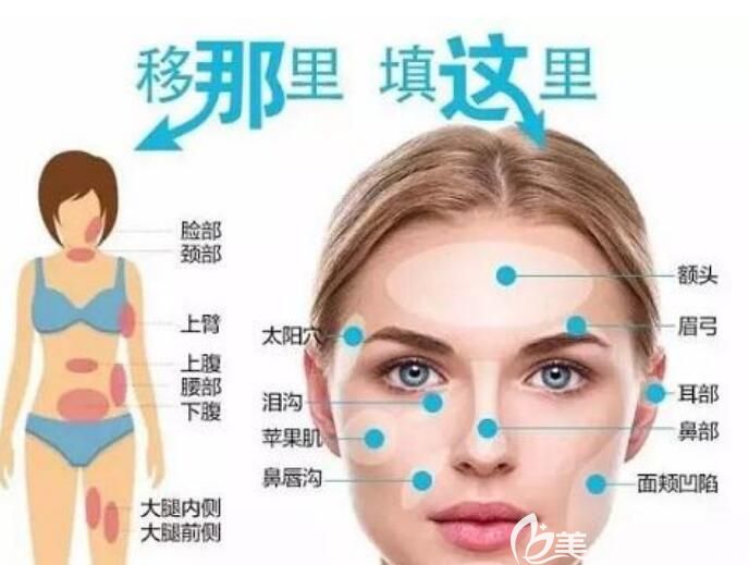 自体脂肪功能介绍