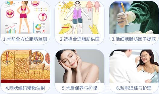 自体脂肪面部填充术的步骤