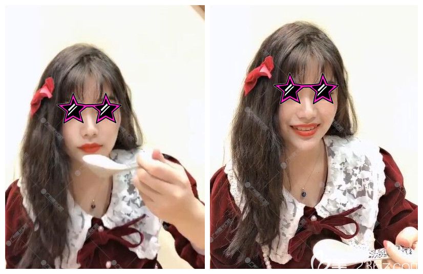 广州曙光口腔初戴牙套体验 广州曙光口腔初戴牙套体验