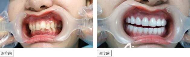 广州曙光矫正牙齿怎么样 广州曙光矫正牙齿怎么样