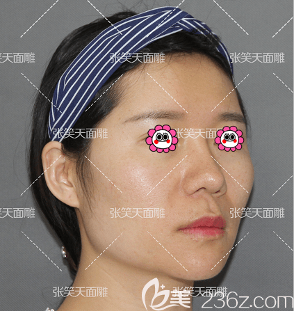 我找张笑天改脸型前样子 我找张笑天改脸型前样子