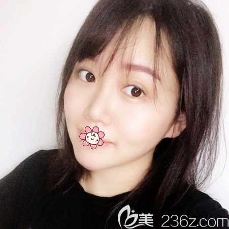 广州军美王娜做吸脂怎么样 广州军美王娜做吸脂怎么样