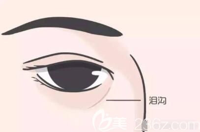 什么是泪沟