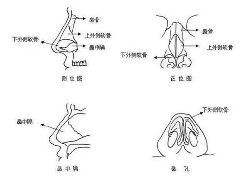 膨体隆鼻可改善鼻部不足 膨体隆鼻可改善鼻部不足