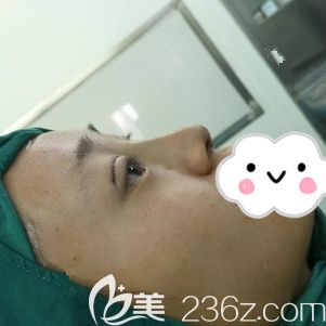 刚做完翘睫美瞳术和<span style= 刚做完翘睫美瞳术和<span style=