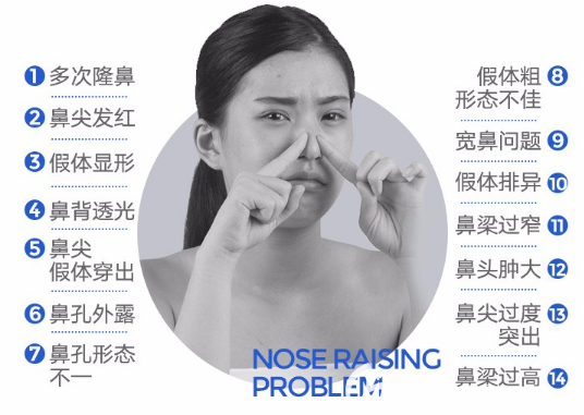 各种隆鼻失败症状