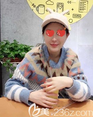 南阳维多利亚自体脂肪面部填充术后45天