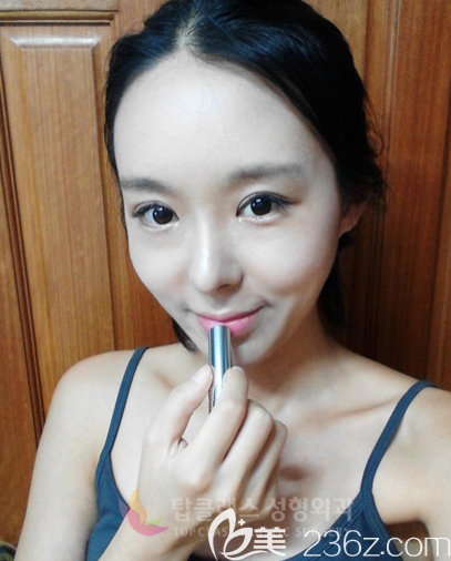 韩国TOPCLASS立体轮廓鼻真人案例