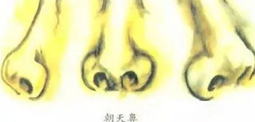 什么是朝天鼻