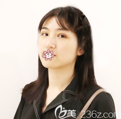 双眼皮术后7天拆线效果 双眼皮术后7天拆线效果