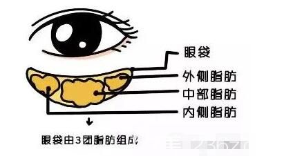 假性眼袋的形成原因