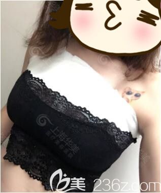 敏感自卑的你做一次娜绮丽假体隆胸后才发现女人挺起来更自信