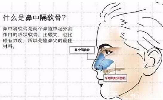 什么是鼻中隔软骨
