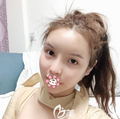 看徐威强做磨骨技术怎么样 看徐威强做磨骨技术怎么样