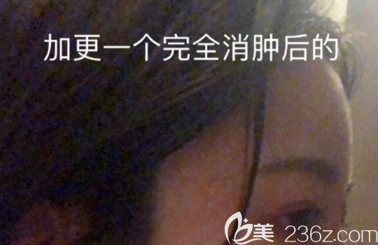 20190819_1566207511131978.png 20190819_1566207511131978.png