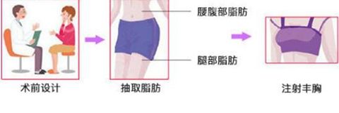 洛阳华美PRP自体脂肪丰胸