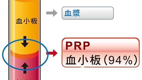 洛阳华美为你讲述什么是PRP