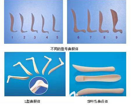 如何从国产假体和进口假体中挑选合适的硅胶隆鼻材料?