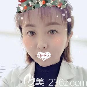 打一针玻尿酸垫下巴够吗?作为注射伊婉丰下巴的过来人给你一个标准答案