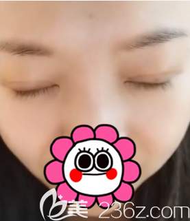 北京圣嘉新眼综合案例