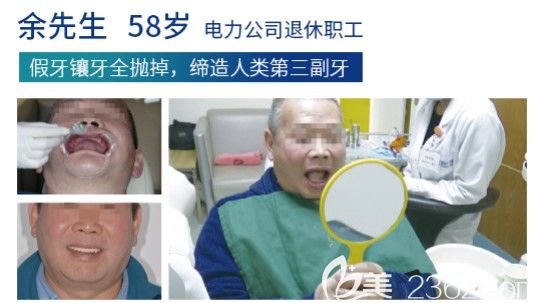 假牙镶牙全抛掉换上全口种植牙 假牙镶牙全抛掉换上全口种植牙