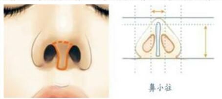 鼻小柱 鼻小柱