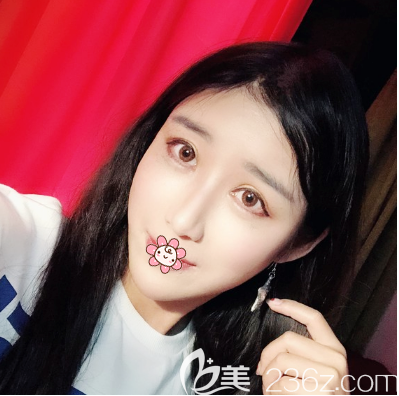 佛山华美祛眼袋效果怎么样