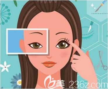 全切双眼皮修复