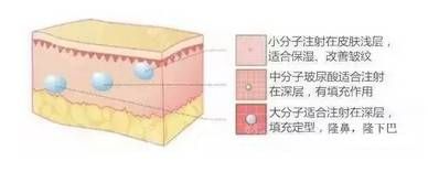 大中小分子不同注射的部位有所差别