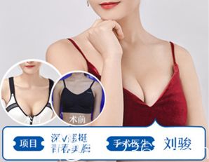 刘骏医生做假体隆胸术后真人对比效果 刘骏医生做假体隆胸术后真人对比效果
