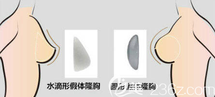 想要做假体隆胸对于水滴形假体和圆形假体应该如何选择