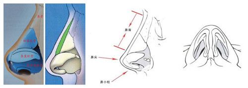 硅胶假体隆鼻手术不会影响到嗅觉 硅胶假体隆鼻手术不会影响到嗅觉