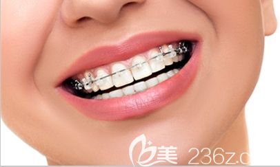 姜丹医生带大家解开有关牙齿矫正的谣言