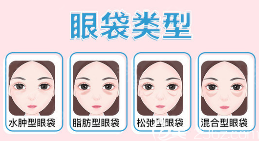 不同类型的眼袋