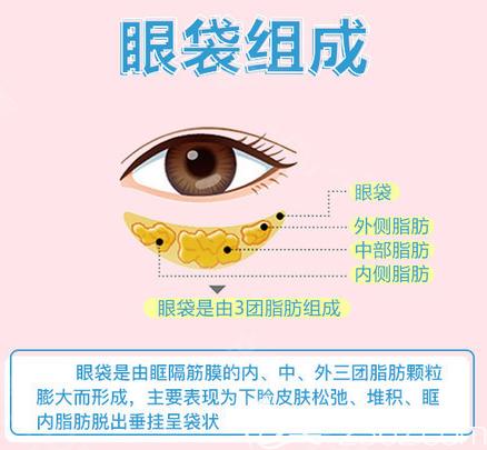 眼袋的组成部位