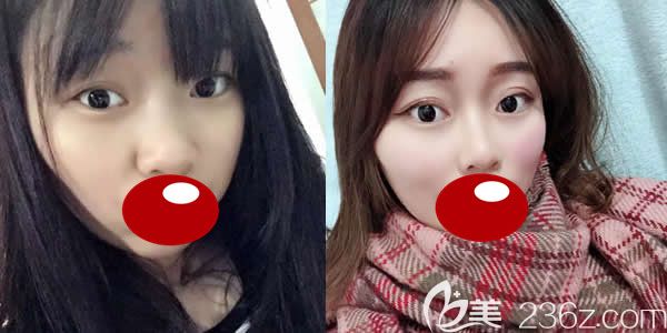 福州名韩整形察鹏飞进口<span style=