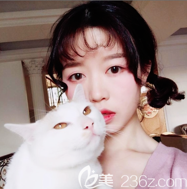 广州广大整形医院隆鼻一个月<span style= 广州广大整形医院隆鼻一个月<span style=