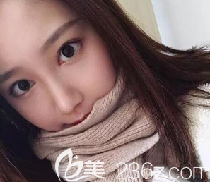 韦小勇医生给我做完手术第十天