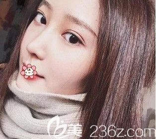 重庆美莱隆鼻怎么样