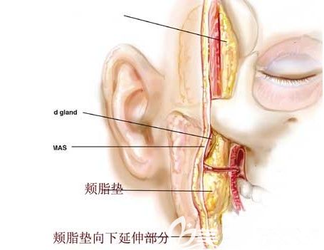 颊脂垫在面部所在部位的结构示意图