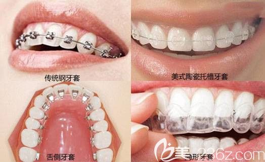 北京维嘉口腔张余新医生擅长项目 北京维嘉口腔张余新医生擅长项目