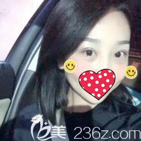 得知沈阳名流美容医院不仅口碑好而且做双眼皮价格也很亲民后我就做了双眼皮修复术！