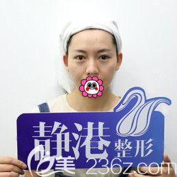 到宁波静港做鼻综合前 到宁波静港做鼻综合前