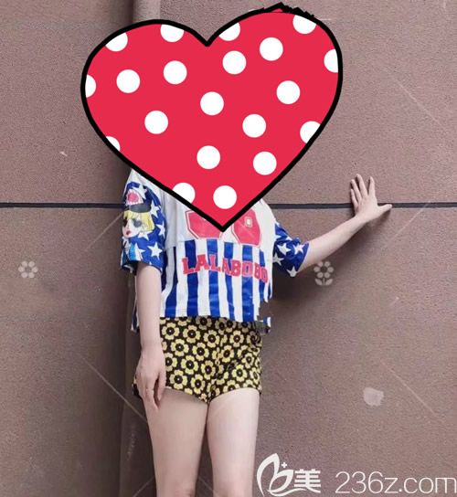 仅仅用了90天,我找赣州薇琳钟林辉做腰腹环吸后裤子直接从XL瘦到了M号