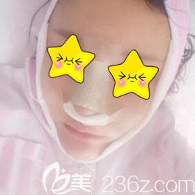 鼻综合+脂肪填充面部术后1天效果 鼻综合+脂肪填充面部术后1天效果