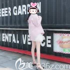 在大连新华美天做吸脂瘦大腿31天效果照 在大连新华美天做吸脂瘦大腿31天效果照