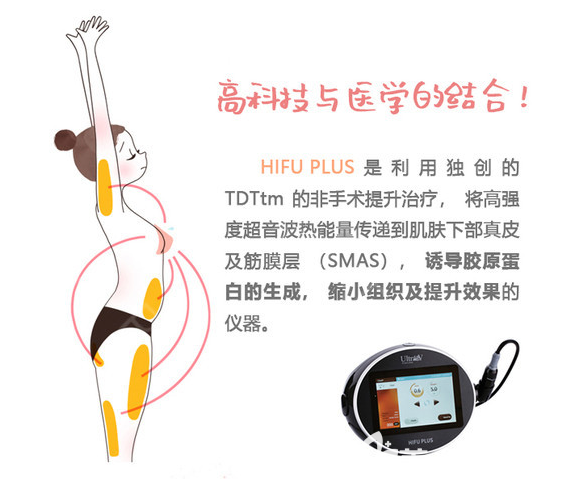 医院引进先进的HIFU PLUS 医院引进先进的HIFU PLUS